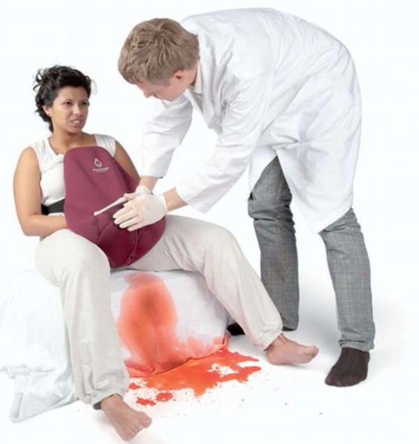Chảy máu bất thường sau sinh